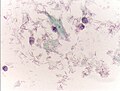 The cytoplasms of squamous epithelial cells melted out; many Döderlein bacilli can be seen.